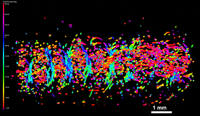 Textile Struktur einer durch Vernadeln in Z-Richtung verstärkten Preform  (CT Schnittbild mit 5 µm Voxelauflösung) 